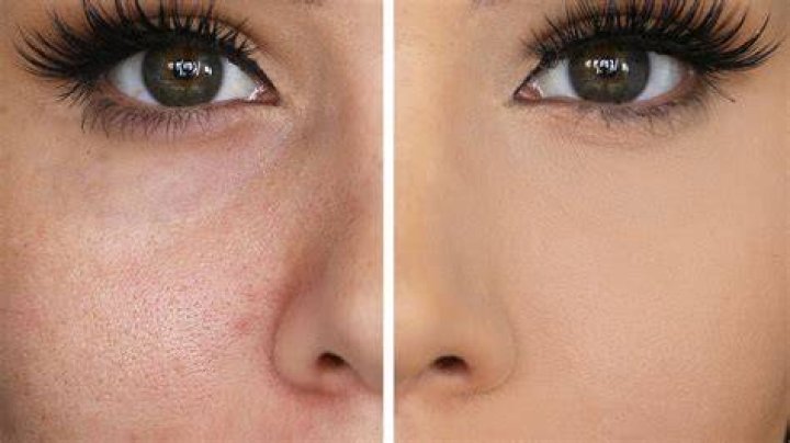 Can you hide pores with makeup?