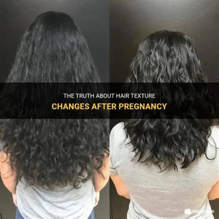 Does hair texture change after pregnancy?