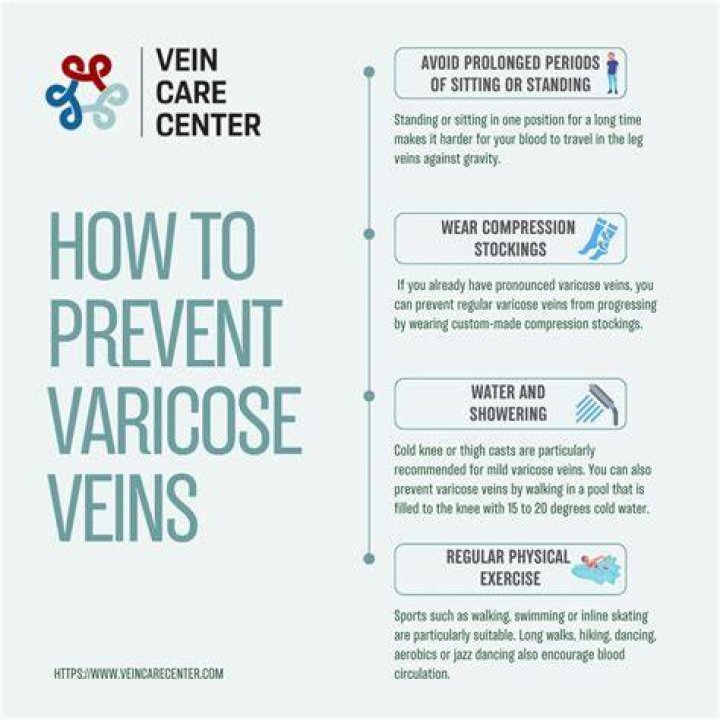 How can I prevent varicose veins?