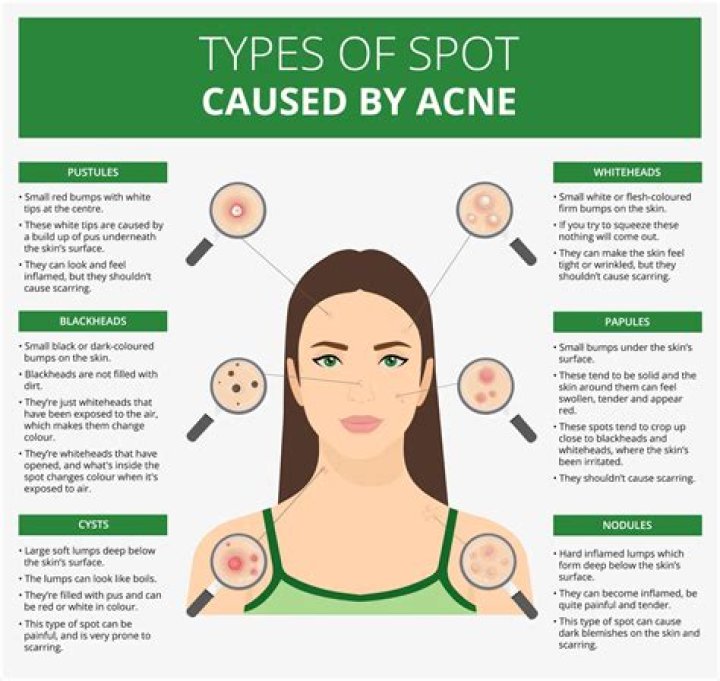 What causes a spot?