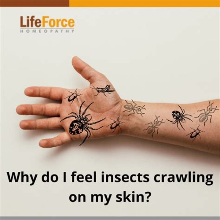 What causes skin crawling?