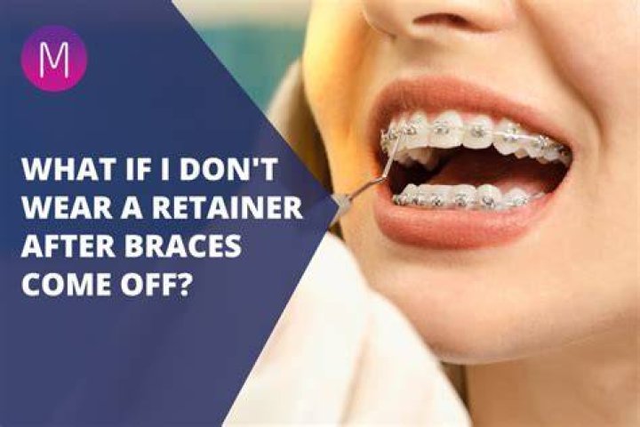 Will wearing a retainer straighten my teeth?